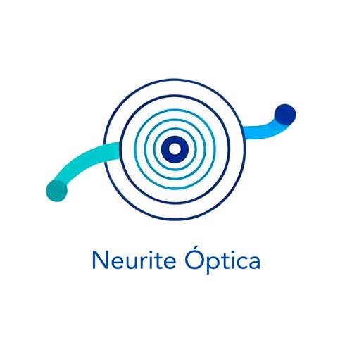 Neurite Optica